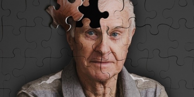 Alzheimerı tedavi eden molekül keşfedildi
