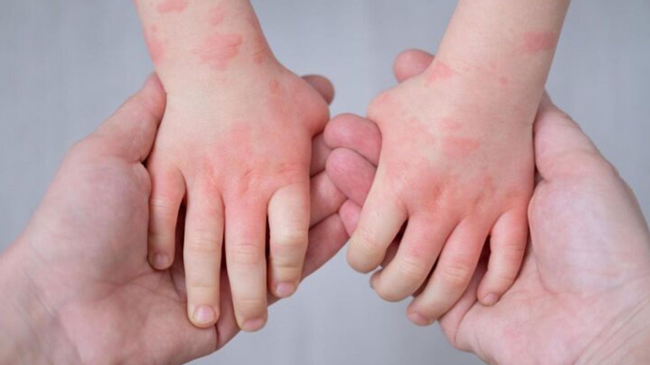 Aman çok dikkatli olun! Masum sandığınız besinler tehlike saçabilir