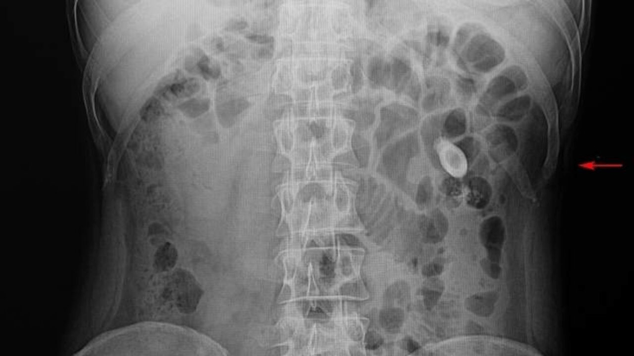 Aman dikkat! Ağrıdan delirten hastalık sessiz ilerliyor...