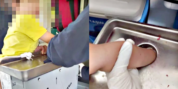 Aman dikkat! Kıyma çekerken elini makineye kaptırdı...