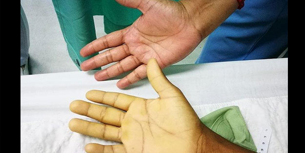 Aman dikkat! Türkiye'nin yüzde 2,1'i bu hastalığı taşıyor