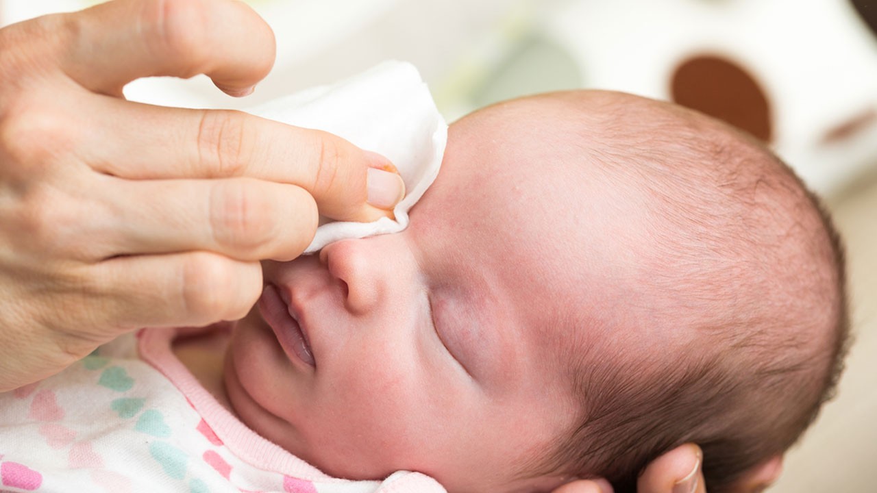 Aman dikkat! Yeni doğan bebeklerde görülüyor