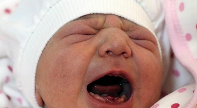 Amasya'da dokuz dişli doğdu