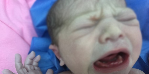 Amasya'da görenleri şaşkına çeviren doğum!