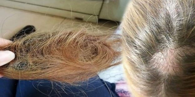 Sağlık meslek lisesi öğrencisi bile bunu yaparsa..