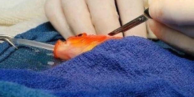 Ameliyat masasında japon balığı