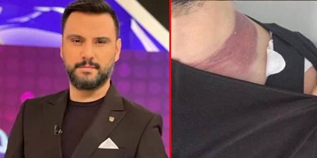Ameliyatta ölümden döndüğünü açıkladı! Alişan'dan doktoruna rekor tazminat davası
