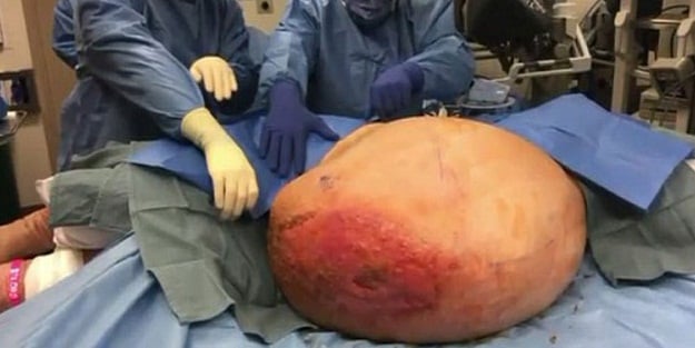 Ameliyatta şok oldular!