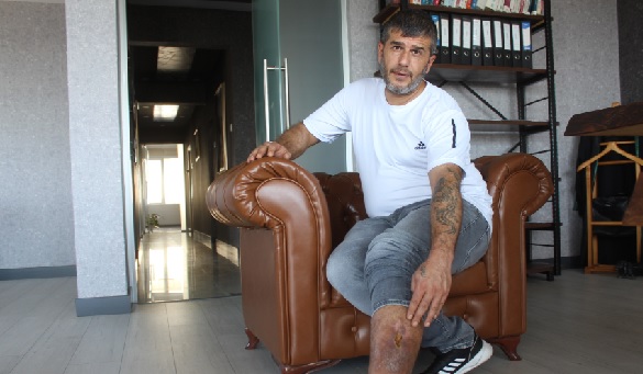 Ameliyatta unutulmuş! 16 senedir bakın nasıl yaşamış