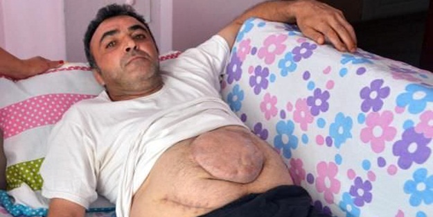 Ameliyattan sonra bu hale geldi