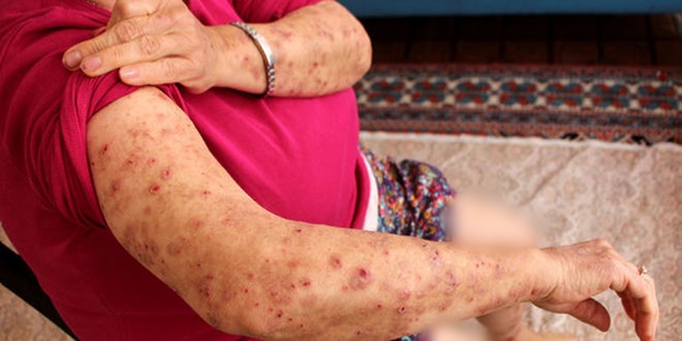 Ameliyattan sonra bu hale geldi