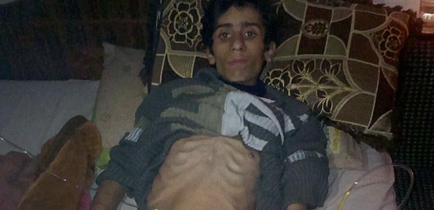 Madaya'da açlıktan ölümler devam ediyor