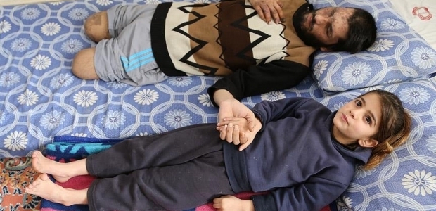 'Gözlerimi alıp babama verin, beni sevsin'