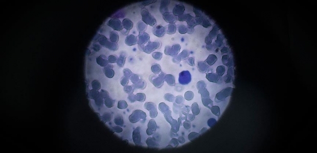 Zika virüsü oraya kadar ulaştı