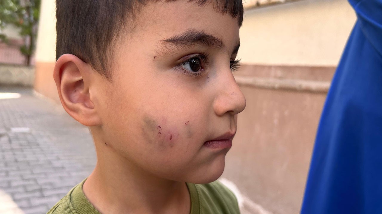 Ankara’da dehşet! Evde uyuyan çocuk kanlar içerisinde uyandı