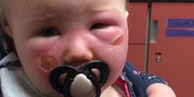 Annesi yüzüne krem sürdü, bu hale geldi