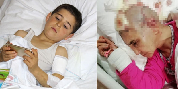 2 sokak köpeği saldırısı daha: Kafa derisini yüzdüler!