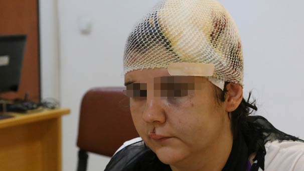 Antalya'da gözü kör olmasın diye yüzünü korumaya çalışırken eli parçalandı!