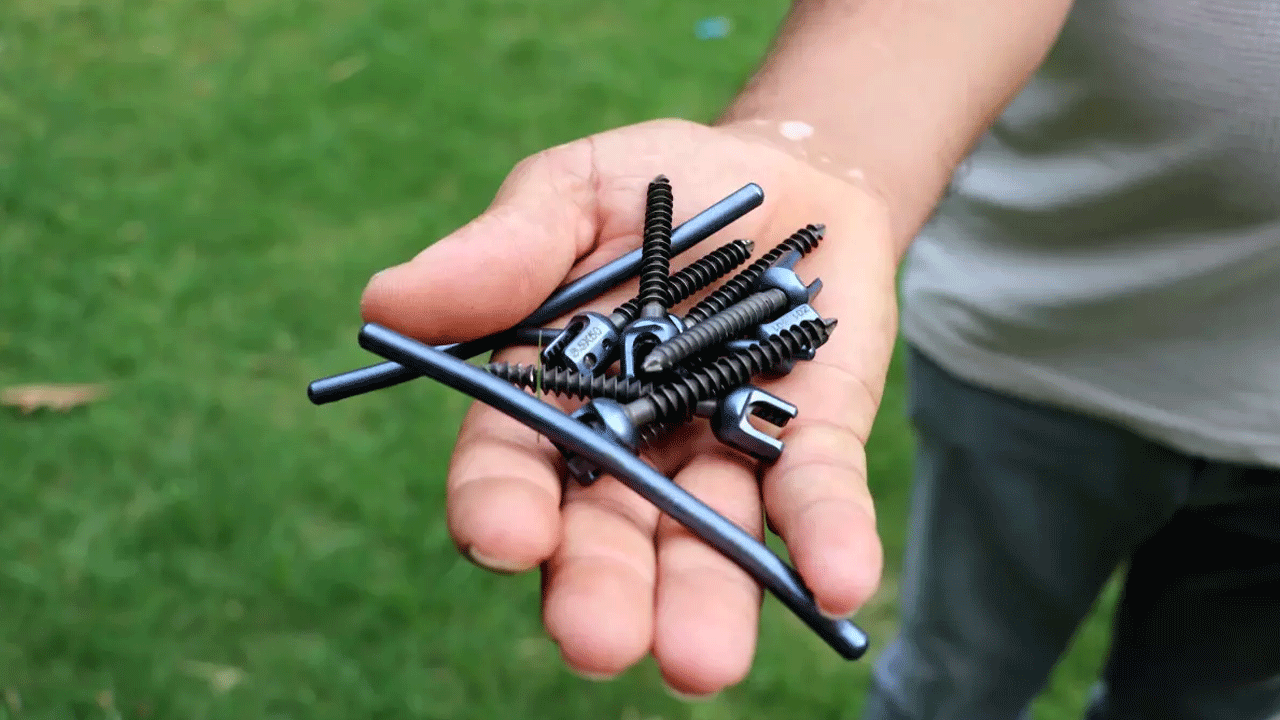 Antalya'da inanılmaz Olay! Haberi olmadan vücuduna 8 platin takıldı