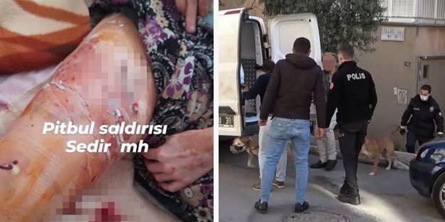 Bunun hesabını kim verecek? Pitbull saldırısına uğrayan kadın bacağından olabilir!