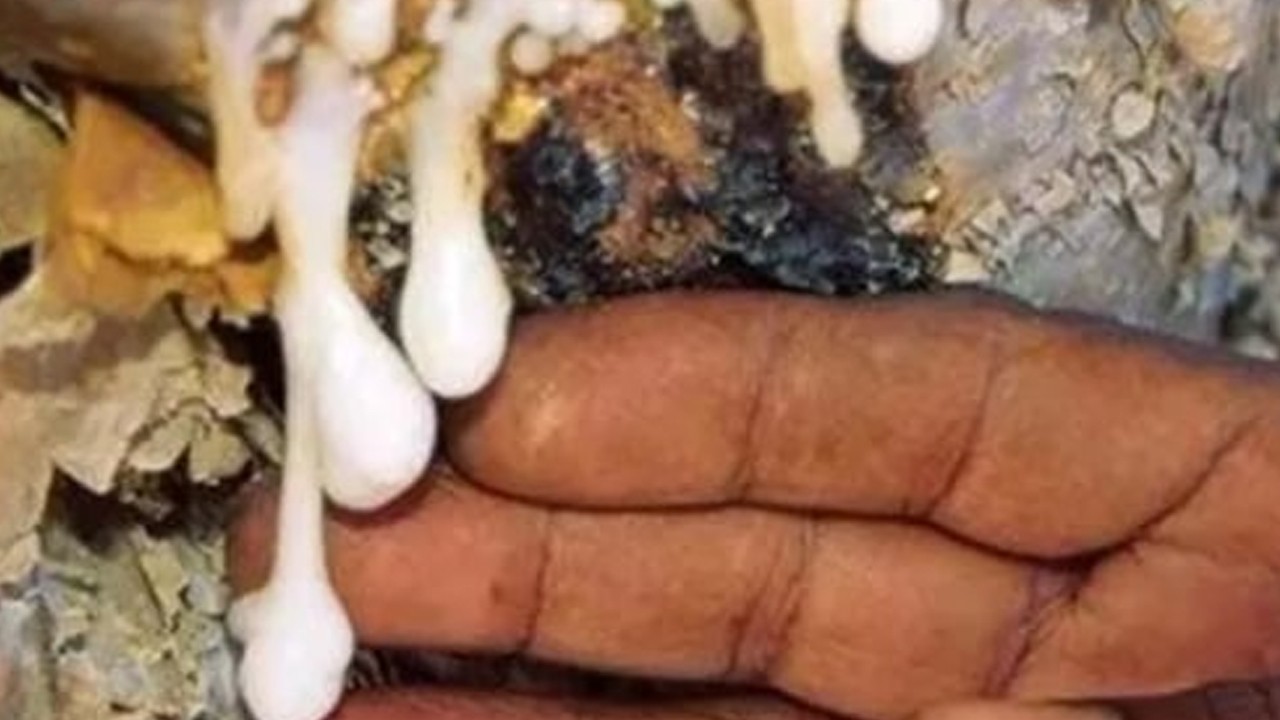 Antibiyotik almaya son! İşte iltihaba meydan okuyan bitki! geçmeyen öksürüğün nedeni yok oluyor