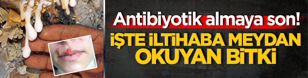 Antibiyotik almaya son! İşte iltihaba meydan okuyan bitki
