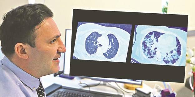 Antikor seviyelerimizi virüse yakalanmadan artırmak hayati önemde