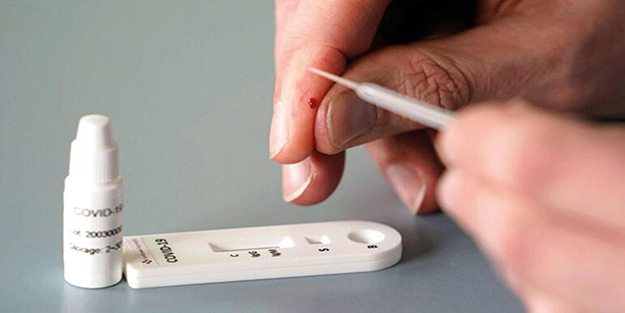 Antikor testi nedir, nasıl yapılır?