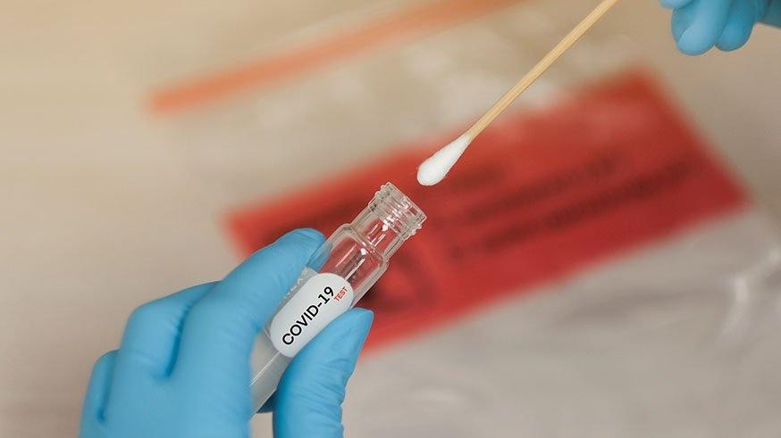 Antikor testi nedir, nerede nasıl yapılır? Antikor testi kimlere yapılır?