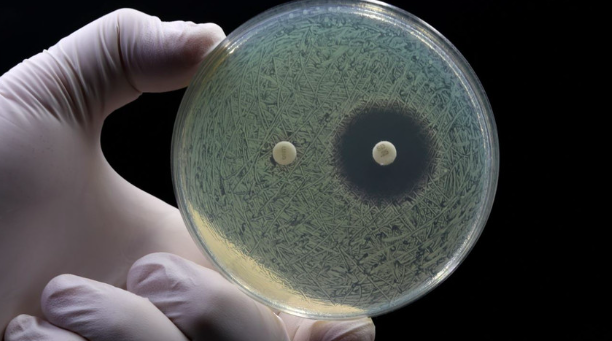Antimikrobiyal direnç alarmı! 40 milyon kişi ölebilir