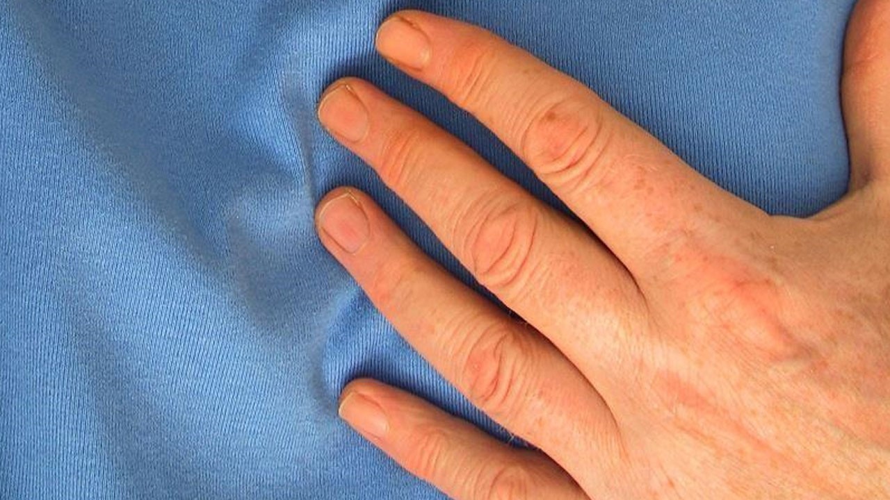 Aort yırtılması sessiz geliyor!