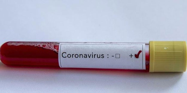 Arap ülkelerinde koronavirüs vaka sayıları arttı