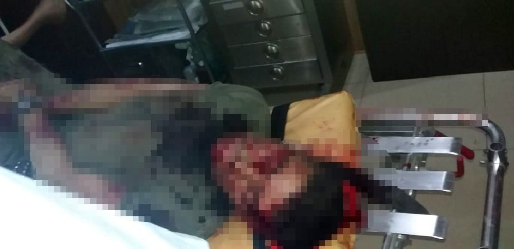 Arfrin’de bombalı saldırı: 2 ölü, 11 yaralı 