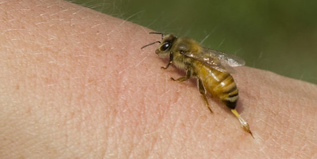 Arı sokmasına ne iyi gelir?