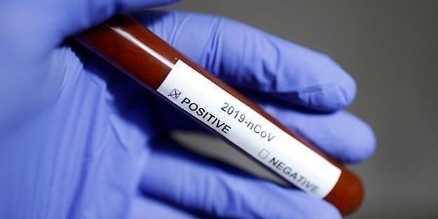 Arjantin ve Şili'deki koronavirüs vakaları yükseliyor