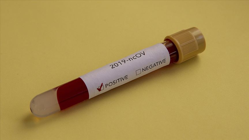 Arjantin'de koronavirüsten ilk ölüm