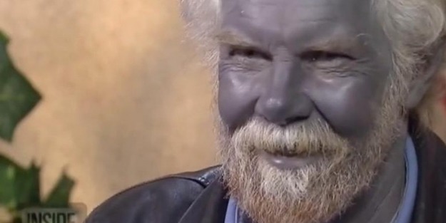 Arjiri hastalığı nasıl oluşur?