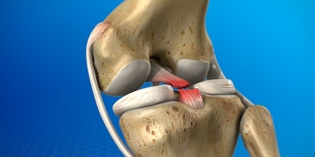 Artık 15 dakikada menisküs ameliyatı yapılıyor