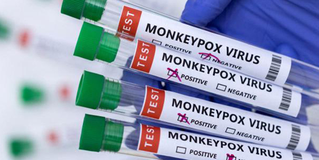 Aşıkolik oldular: Avrupa'da maymun çiçeği virüsüne karşı aşılama