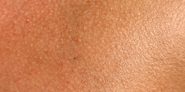 Aşırı hijyen deri için zararlı