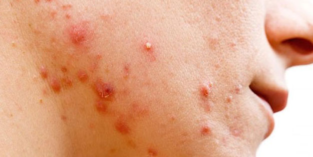 Aşırı şeker tükettiğinizde vücudunuzda bunlar oluyor