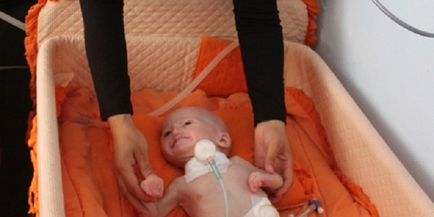 'Aslan Sendromu'yla doğdu - FOTO