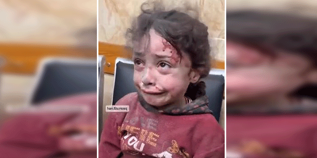 Ateşkese saatler kala hala hastaneye yaralı çocuklar geliyor!