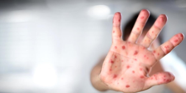 Avrupa ülkesinden 21 gün karantina kararı! Yeni virüs alarmı