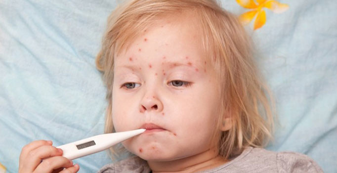 Avrupa’da kızamık vakaları 4 kat yükseldi