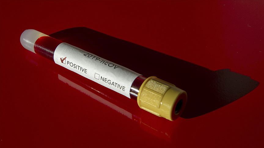 Avrupa'daki Kovid-19 vakaları hergün artıyor