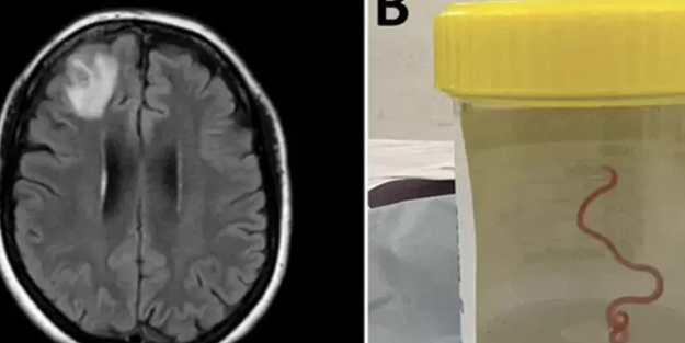 Avustralyalı doktordan dünyayı şoka sokan buluş: Böyle anlatsam da tıpta bir ilk! Doğruysa düşündürücü