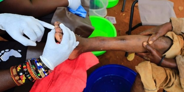 Ayağında öyle bir şey tespit edildi ki! İnanılmaz!