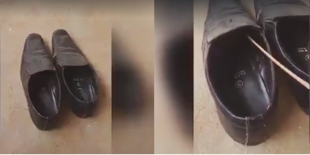 Ayakkabısının içinden öyle bir şey çıktı ki...