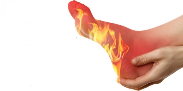 Ayaklarda yangın var!